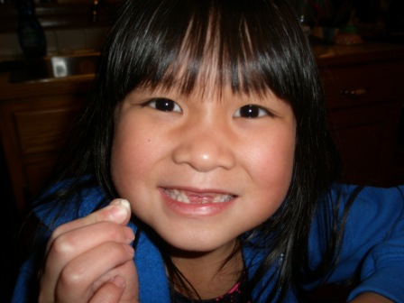 Kasen lost her second tooth